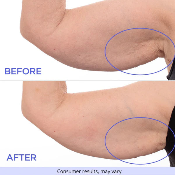 Aura Skin™ Sculpt & Tone Arm Cream
