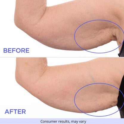 Aura Skin™ Sculpt & Tone Arm Cream