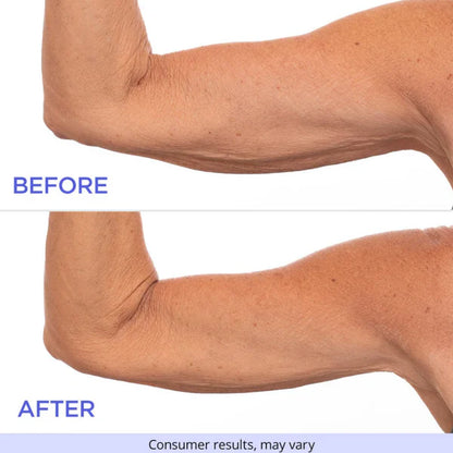 Aura Skin™ Sculpt & Tone Arm Cream